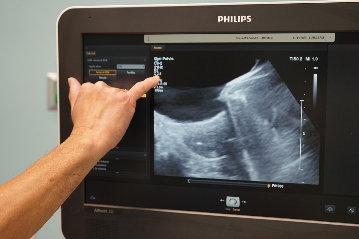 A hand pointing the pinky finger at a screen showing an ultrasound