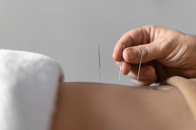 Close-up of acupuncture